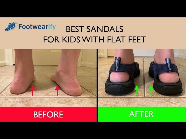 Best Arch Support Sandals for Flat Feet Kids